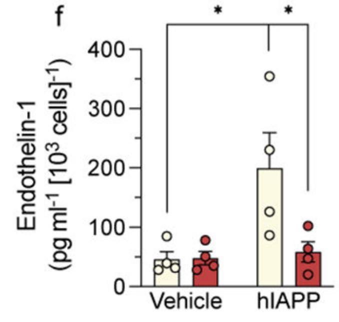 Relative gene expression of endothelin-1 protein secreted from MS-1 cells.jpg